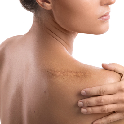 medische-pigmentatie